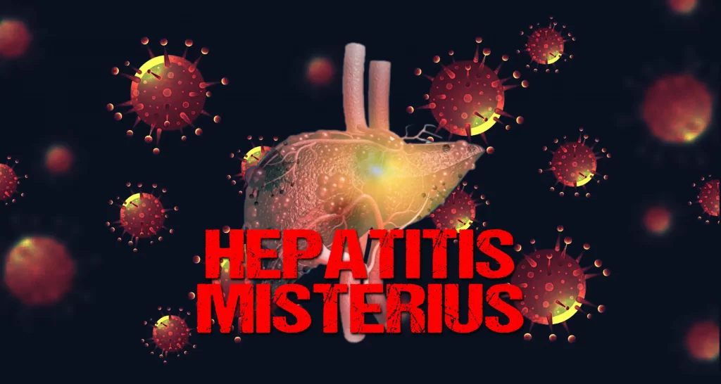 HEPATITIS MISTERIUS - Pandemi COVID-19 baru saja berlalu, tetapi kita kembali dikejutkan dengan adanya informasi tentang hepatitis misterius