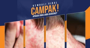 Kesehatan Campak Mei 26 copy